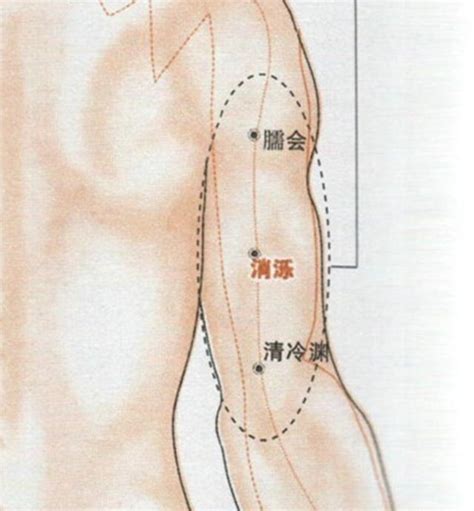 消積穴|消濼穴位置 